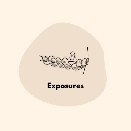 Impacted Teeth
